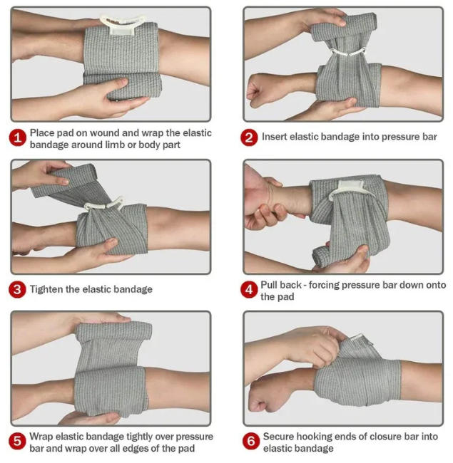 Subitis Bandage usus gradus
