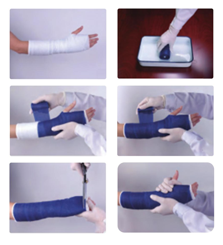 Vestigia utendi orthopaedicarum mittentes Tape