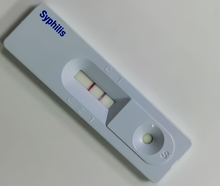 Syphilis antigen celeri test habena